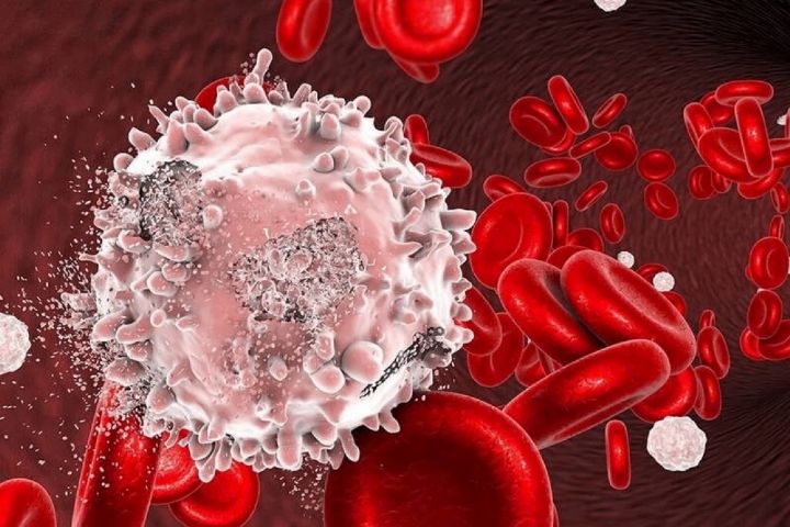 نگاهی به موفقیت كشور در درمان سرطان خون با ژن درمانی