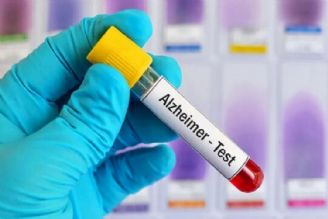 تشخیص آلزایمر با آزمایش خون چگونه است؟