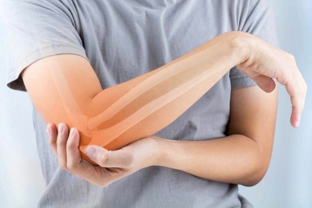 متخصص روماتولوژی: خشكی مفاصل را در اول صبح جدی بگیرید