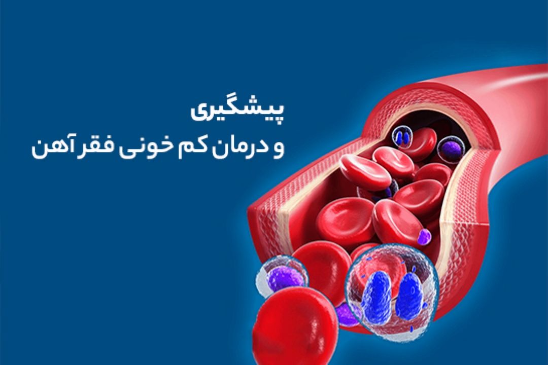 درباره‌ی كم‌خونی ناشی از فقر آهن بیشتر بدانید