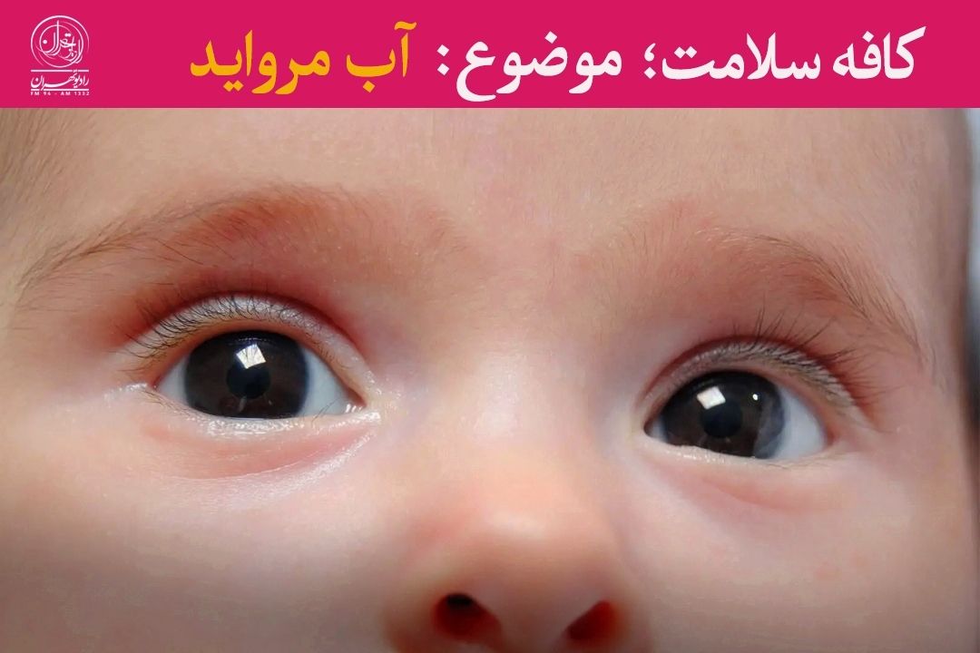 نقش تشخیص زودهنگام در درمان آب مروارید نوزادان