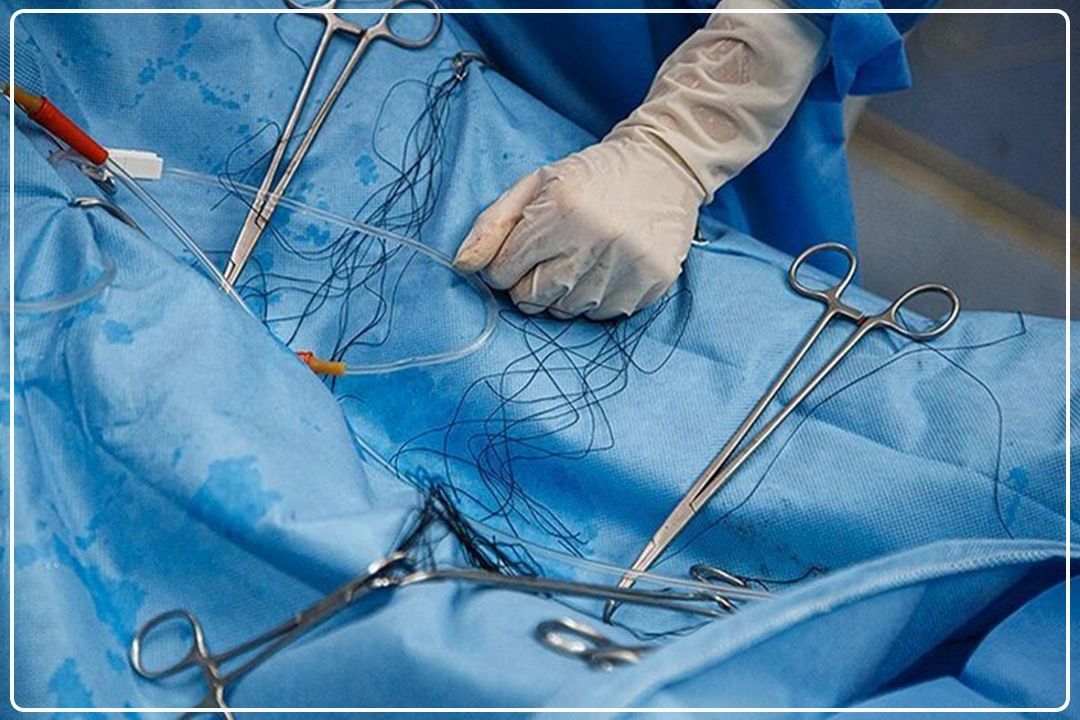  هشدار مجلس درباره خطرات جراحی‌های زیبایی؛ برخورد قانونی با متخلفان