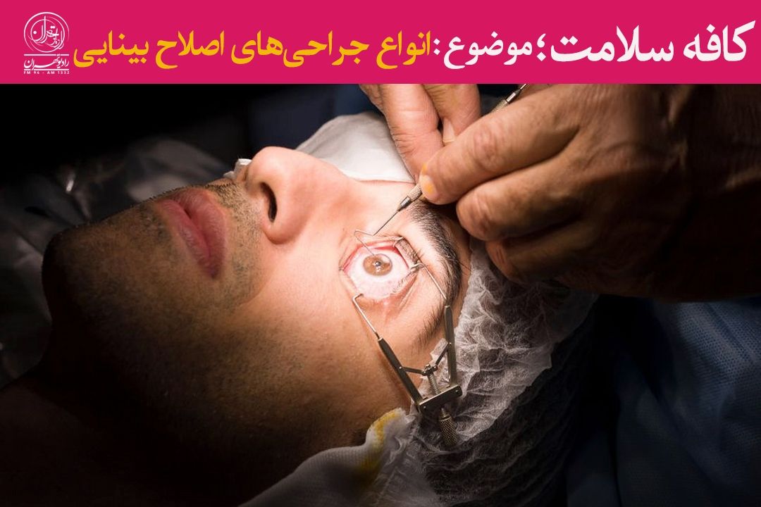 معرفی جراحی‌های اصلاح بینایی: لازك، لیزیك، فمتولیزیك و اسمایل