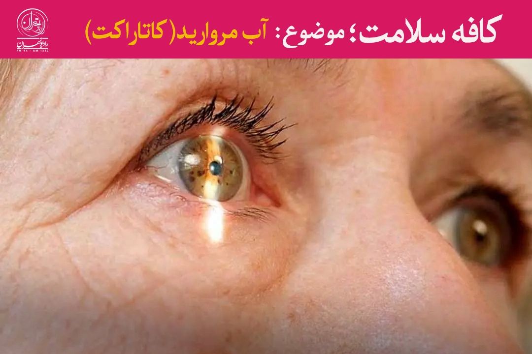 پیشگیری از آب مروارید با چند عادت ساده!