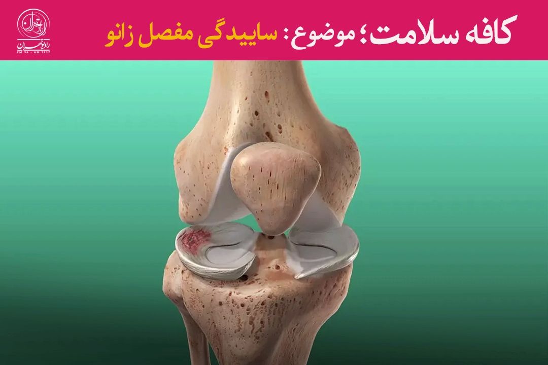  آسیب‌های زانو؛ از علل شایع تا راه‌های پیشگیری و درمان با فیزیوتراپی