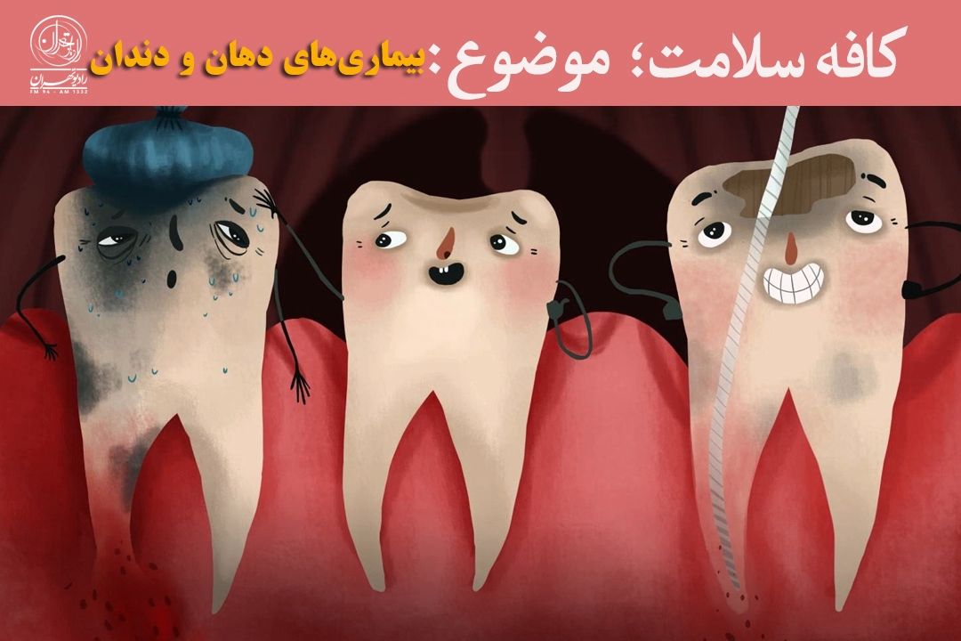رایج‌ترین بیماری‌های دهان و دندان را بشناسیم