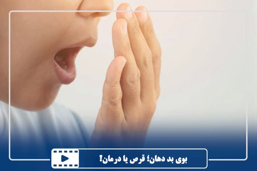 بوی بد دهان؛ قرص یا درمان؟
