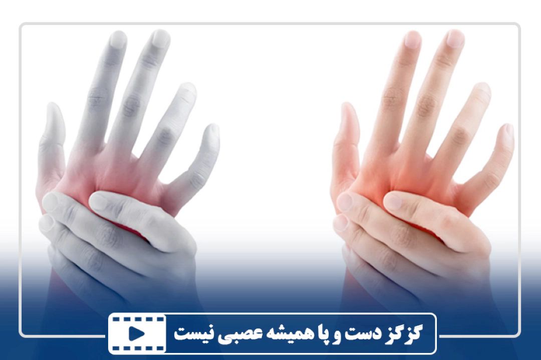 گزگز دست و پا همیشه عصبی نیست