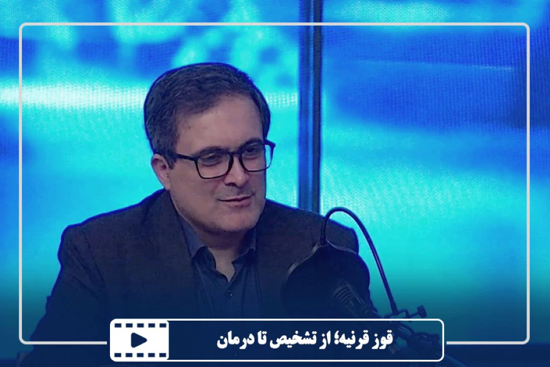 قوز قرنیه؛ از تشخیص تا درمان