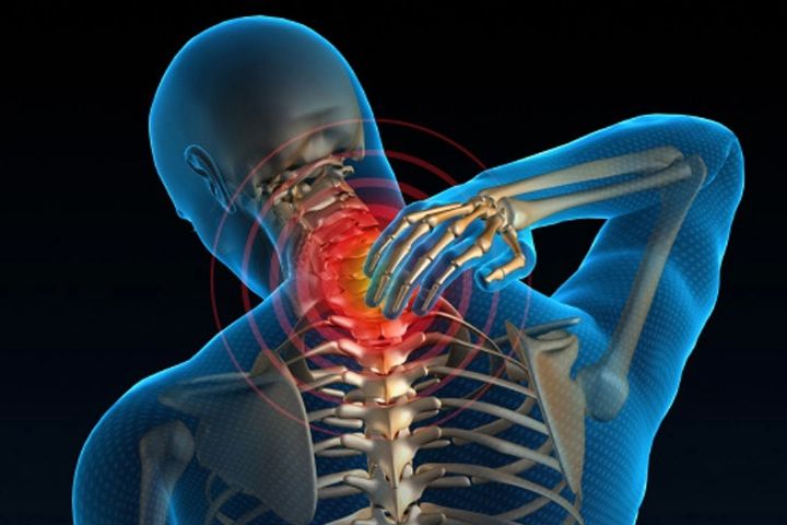 چرایی دردهای ناحیه گردن / ورزش به كمك «گردن درد» می آید