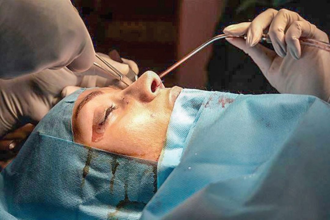 پشت پرده رتبه بالای ایران در عمل‌های زیبایی 