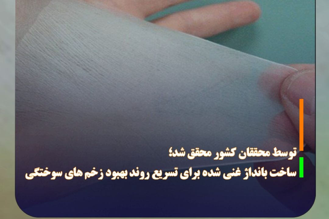 توسط محققان كشور محقق شد؛ ساخت بانداژ غنی شده برای تسریع روند بهبود زخم های سوختگی