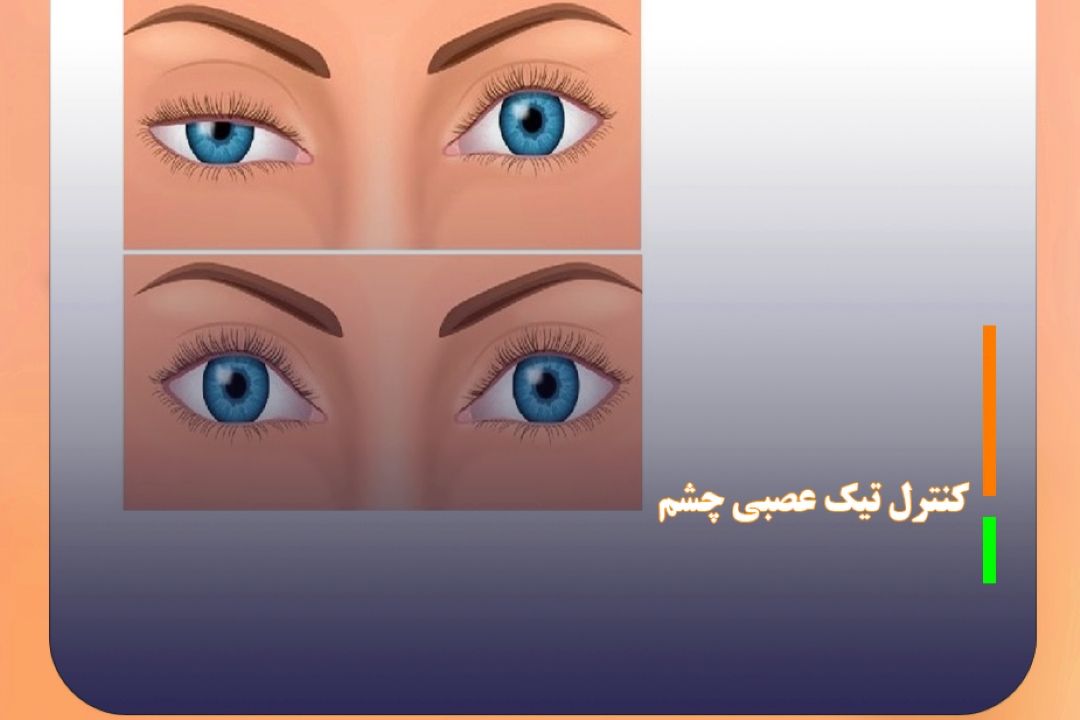 تیك عصبی چشم را چگونه كنترل كنیم؟