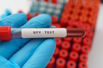 كیت غربالگری ویروس HPV تولید شد 