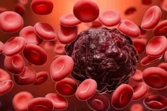 تلاش متخصصان ایرانی برای درمان هوشمندانه سرطان خون 