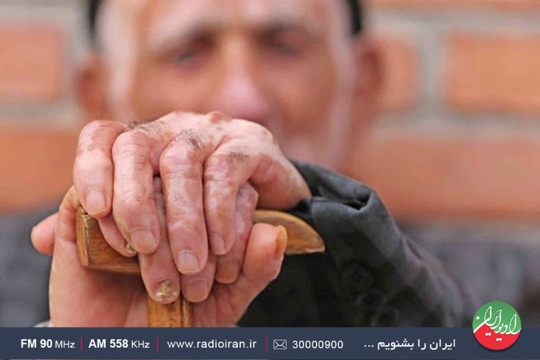 پیشگیری از حوادث دوره سالمندی