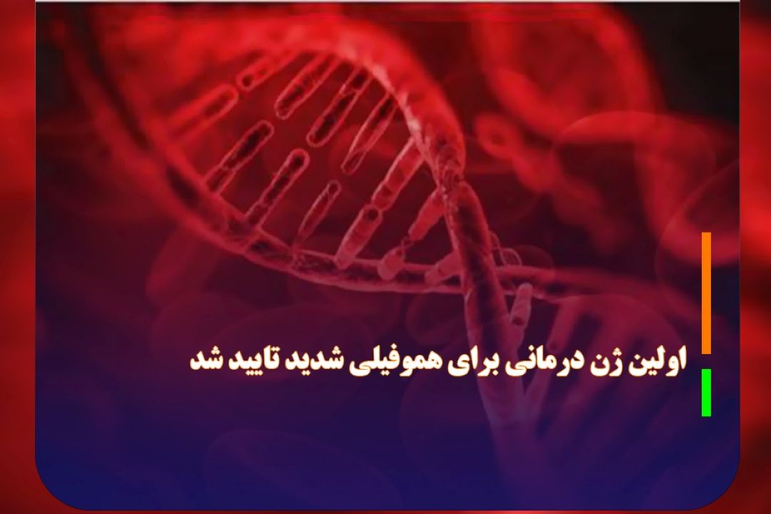 اولین ژن درمانی برای هموفیلی شدید A تایید شد