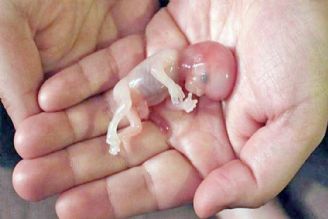 محصولات حاملگی تعداد سقط جنین را كاهش می‌دهد 