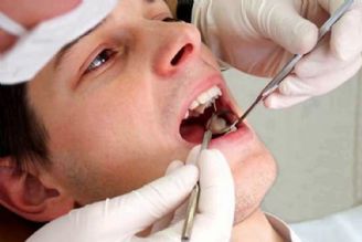 سلامت دهان و دندان و ارتباط آن با مغز 