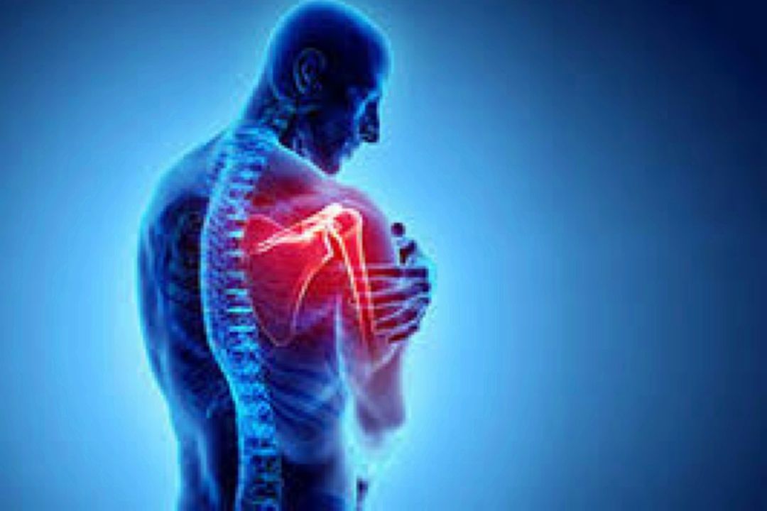 علامت اصلی شانه یخ زده چیست؟