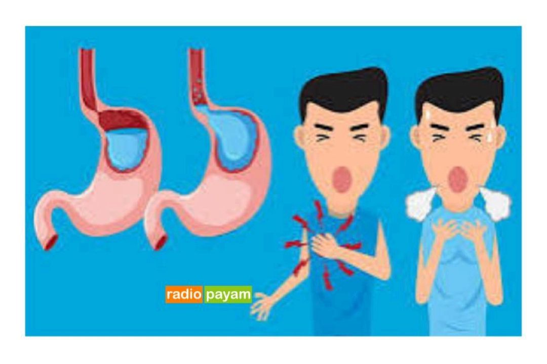  ریفلاكس معده داری این كلیپ رو نگاه كن