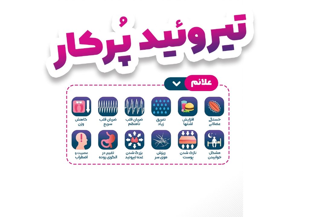 تیروئید پر كار