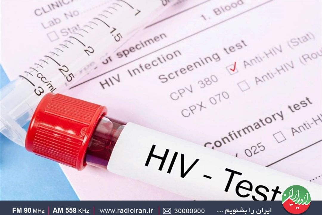 ویروس HIV، اطلاع‌رسانی وسیع می‌خواهد 