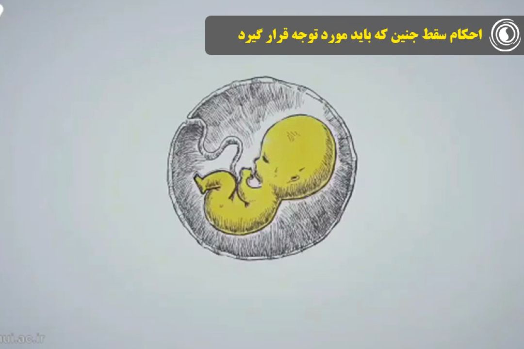 احكام سقط جنین كه باید مورد توجه قرار گیرد
