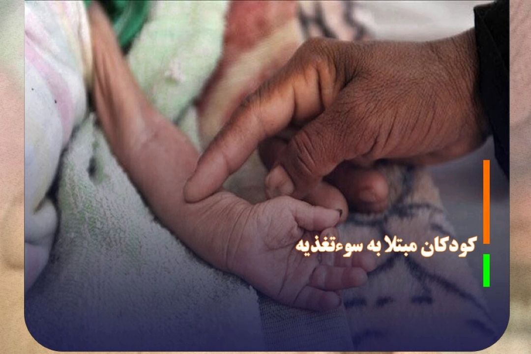 رصد و پایش كودكان مبتلا به سوءتغذیه