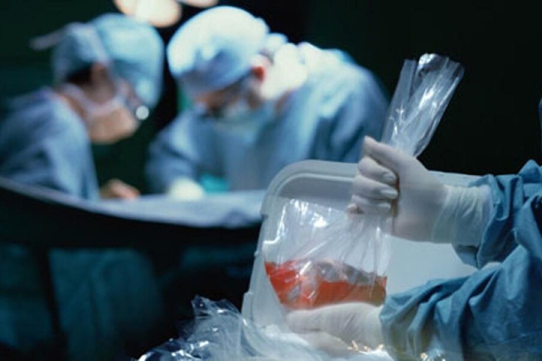 روز ملی اهدا عضو؛ ترویج فرهنگ اهدای عضو