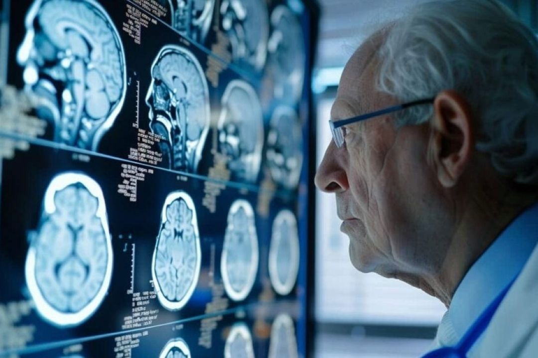 راهكارهای پیشگیری از زوال عقل با تغییر سبك زندگی و توجه به خواب
