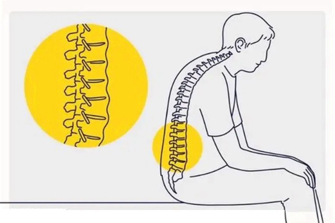 ورزش ساده برای اصلاح قوز پشتی