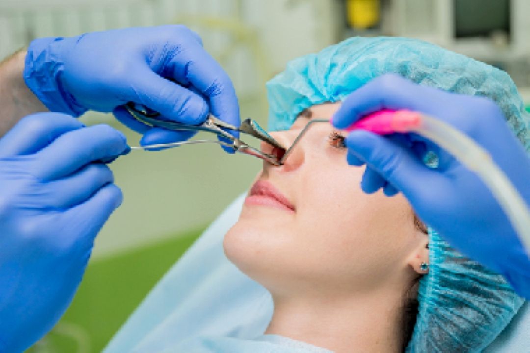 گرفتگی بینی پس از جراحی؛ طبیعی اما قابل پیشگیری