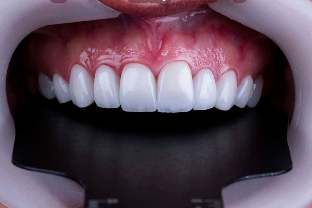 مافیای كامپوزیت