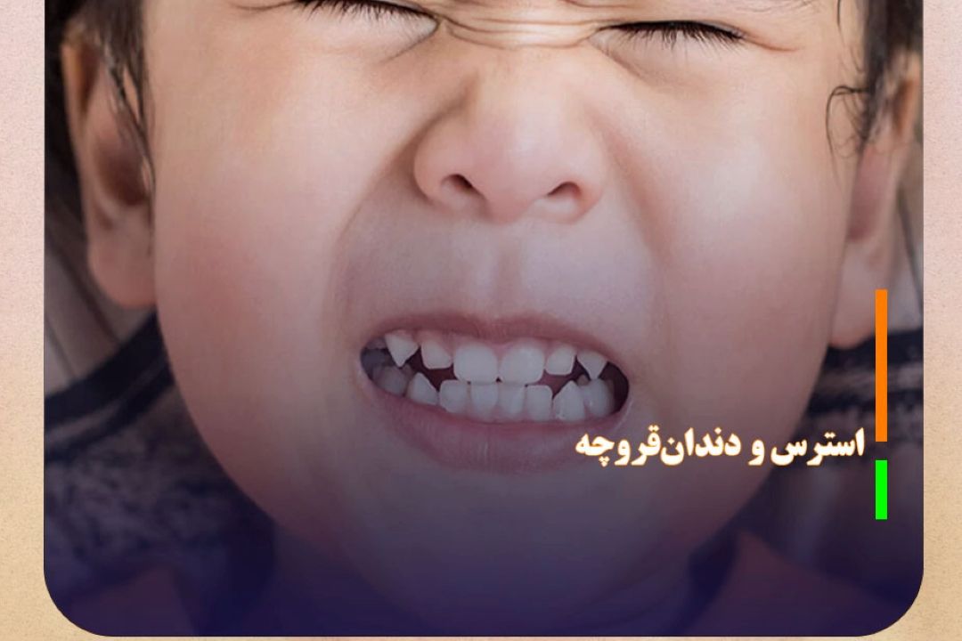 استرس و دندان‌قروچه؛ عامل پنهان بروز دندان‌درد