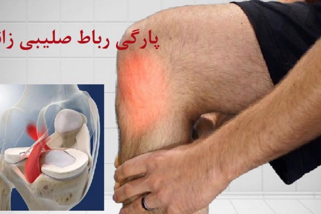 فعالیت جسمانی بعد از جراحی مینیسك و رباط صلیبی  