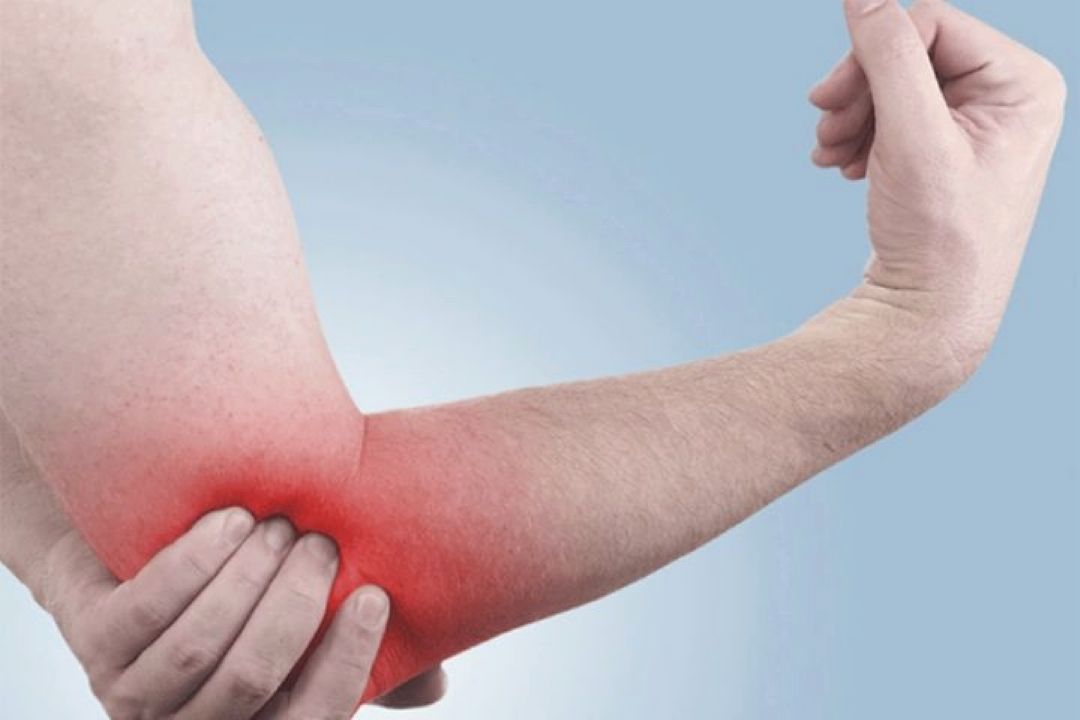 دلایل تورم و درد مفصل آرنج و روش درمان  