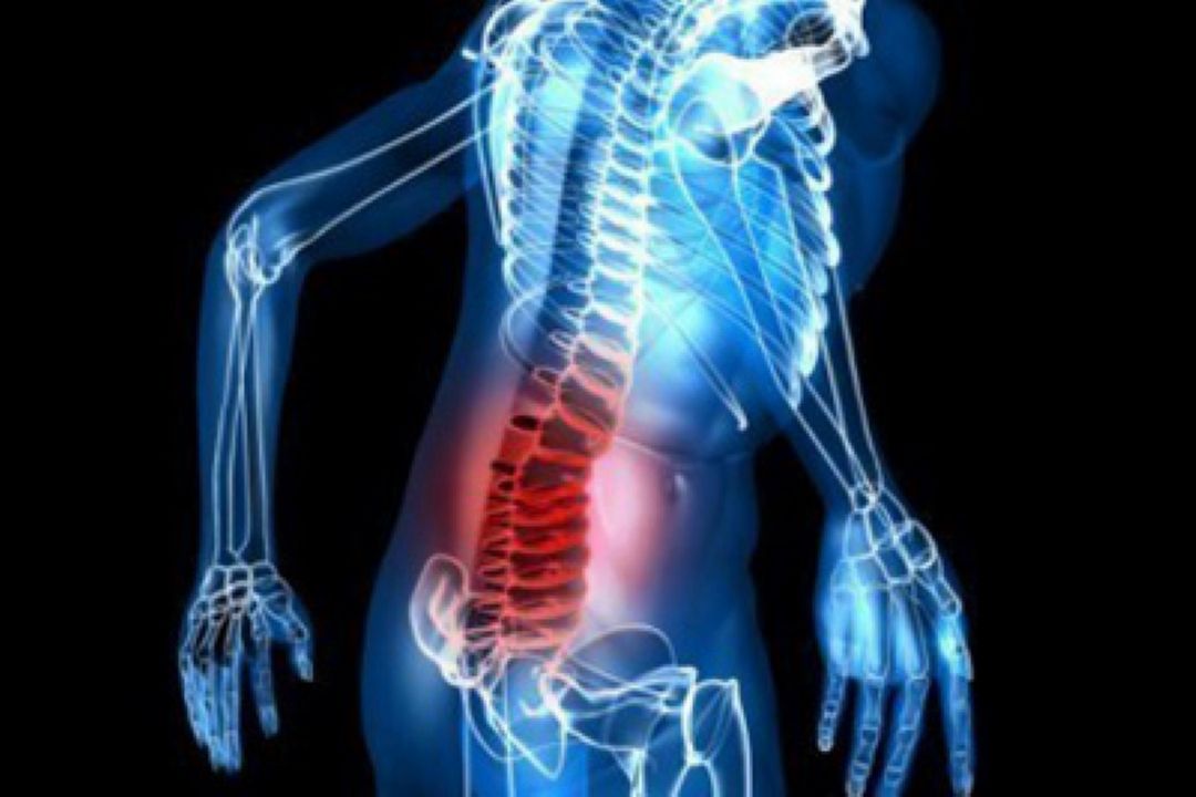 آشنایی با روماتولوژی در "رادیو سلامت "