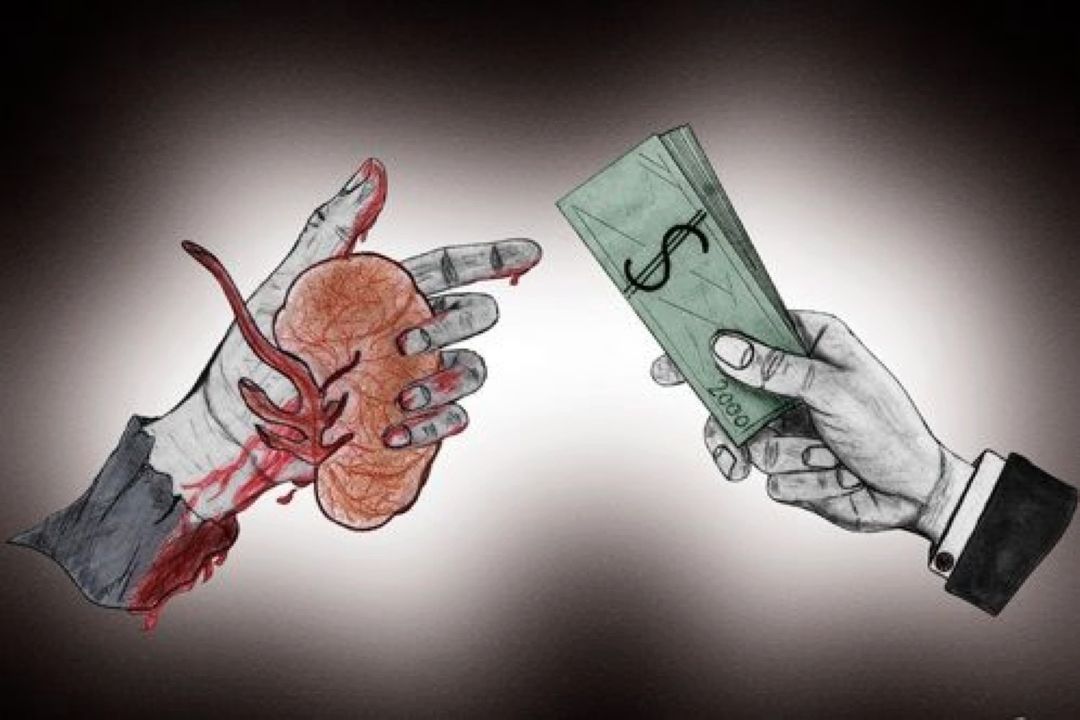 بررسی بازار سیاه فروش كلیه در "رادیو سلامت"  