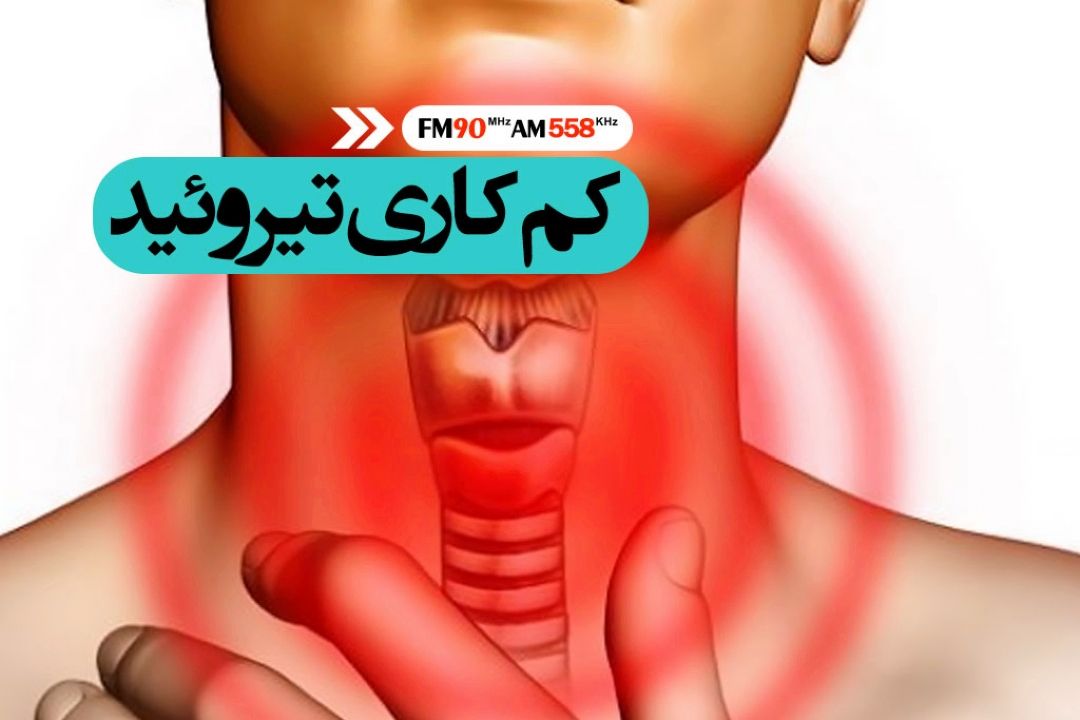 90 درصد كم كاری های مادرزادی غده تیروئید بدون علامت هستند