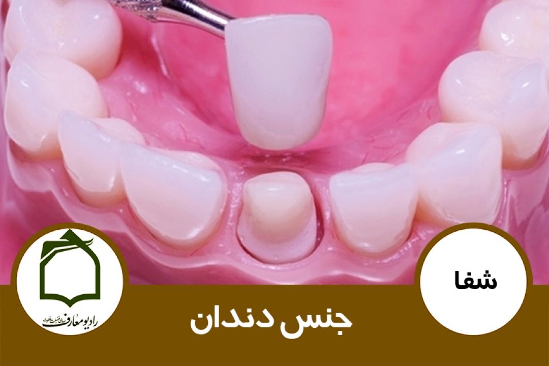جنس دندان 