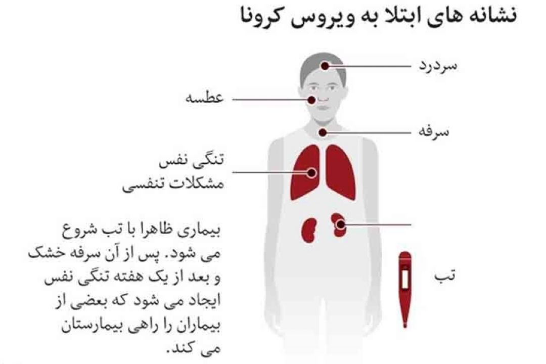 نشانه های ابتلا به كرونا چیست؟