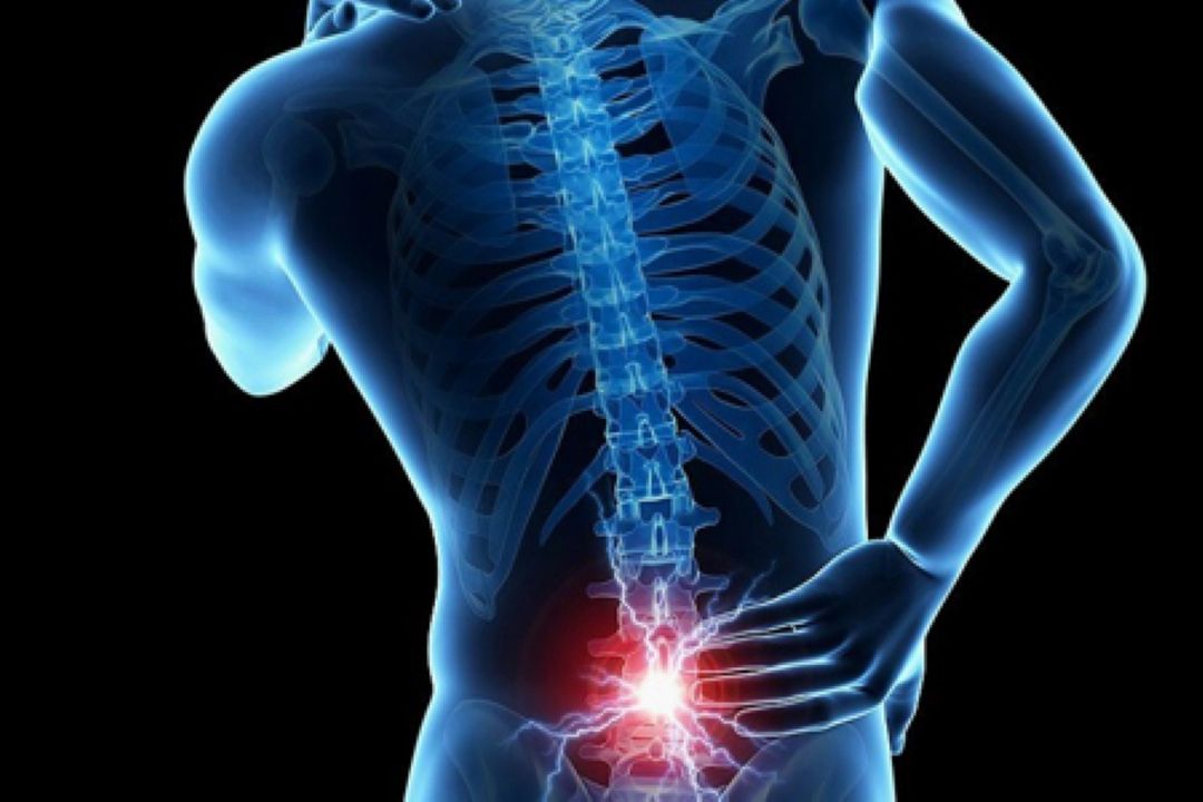 پیاده روی با درد كمری ممكن است؟
