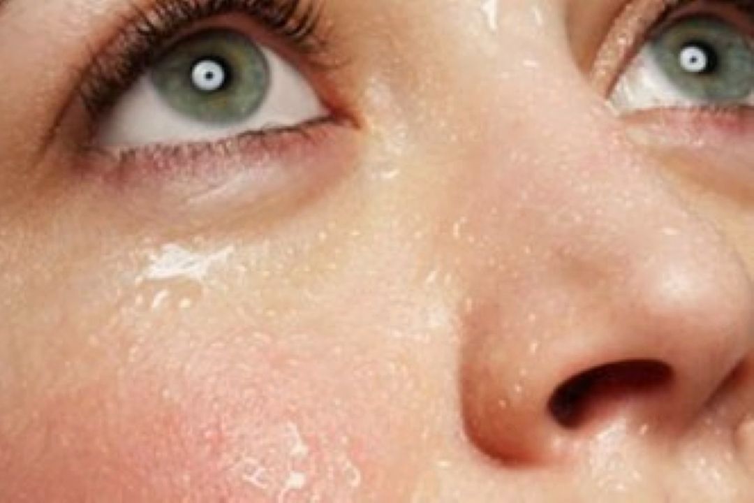 چگونه از پوست خود در برابر عرق محافظت كنیم؟ 