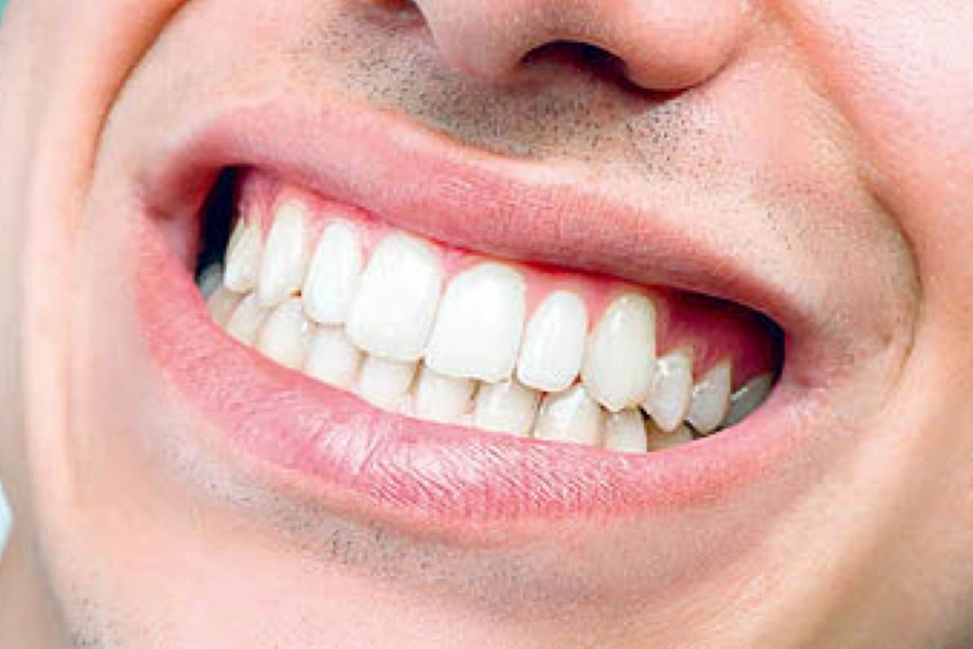 هر زخم ایجاد شده در دهان، آفت نیست