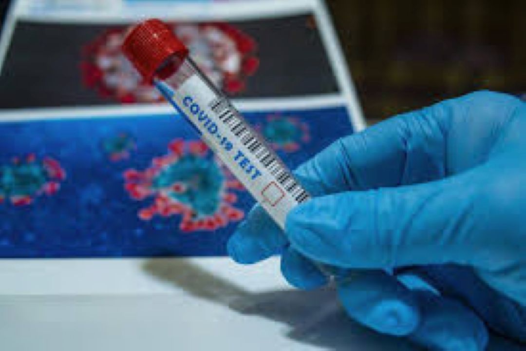 هدف‌گذاری انجام روزانه 100 هزار تست PCR 