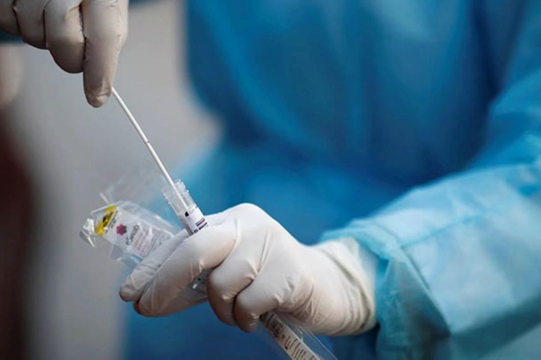 انجام تست PCR برای همه لازم است؟ 