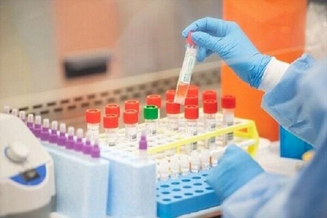 Knowledge-based firms eyeing COVID-19 diagnostic kits' export