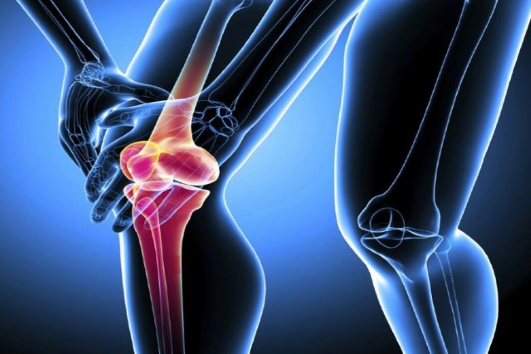 راه‌های جلوگیری از پیشرفت پوكی استخوان را بشناسید.