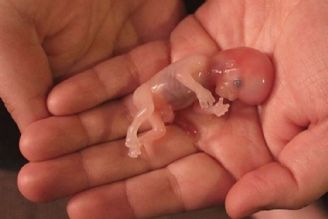 سقط عمدی 350 هزار جنین در سال توسط والدین مشروع